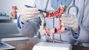 Cada vez más adultos jóvenes son diagnosticados con cánceres gastrointestinales